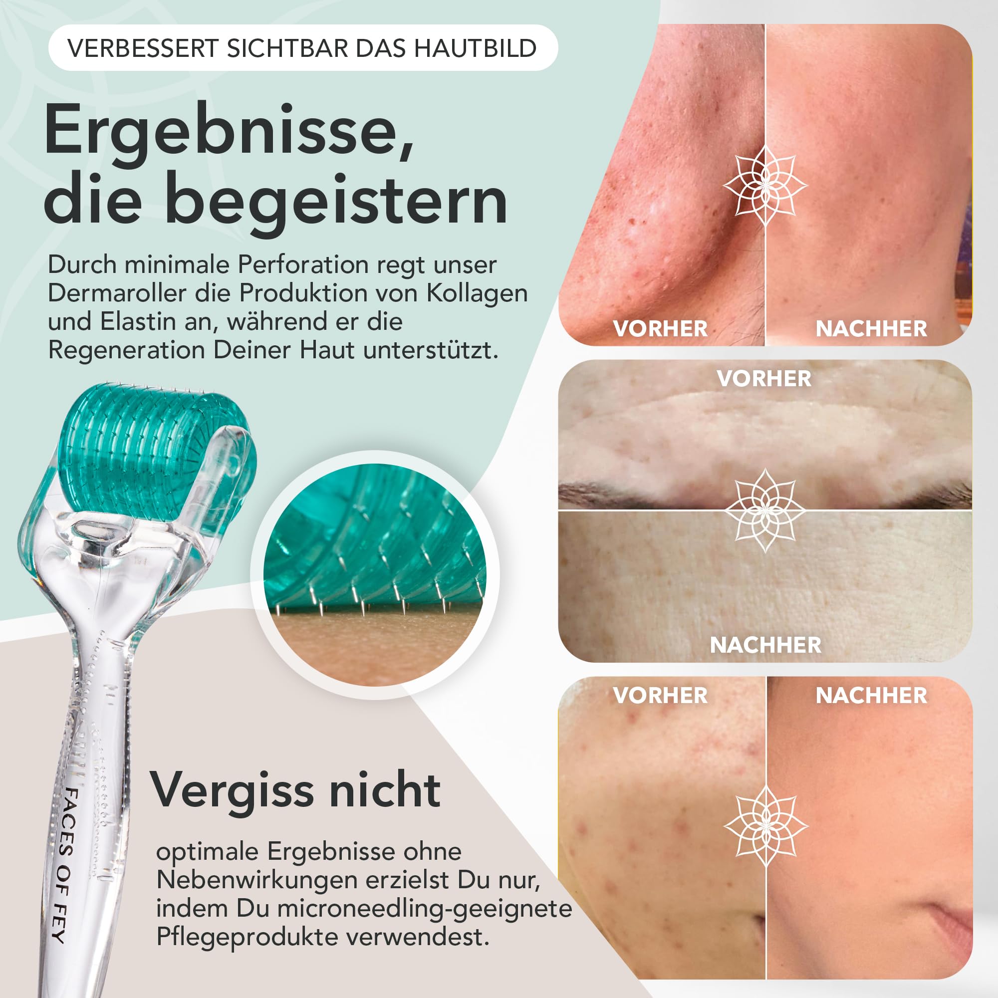 FACES OF FEY Dermaroller Gesicht 0,5mm – 192 Echte Nadeln aus Chirurgenstahl – Microneedling Roller für Gesicht & Körper – Derma Roller für professionelles Micro Needling zuhause