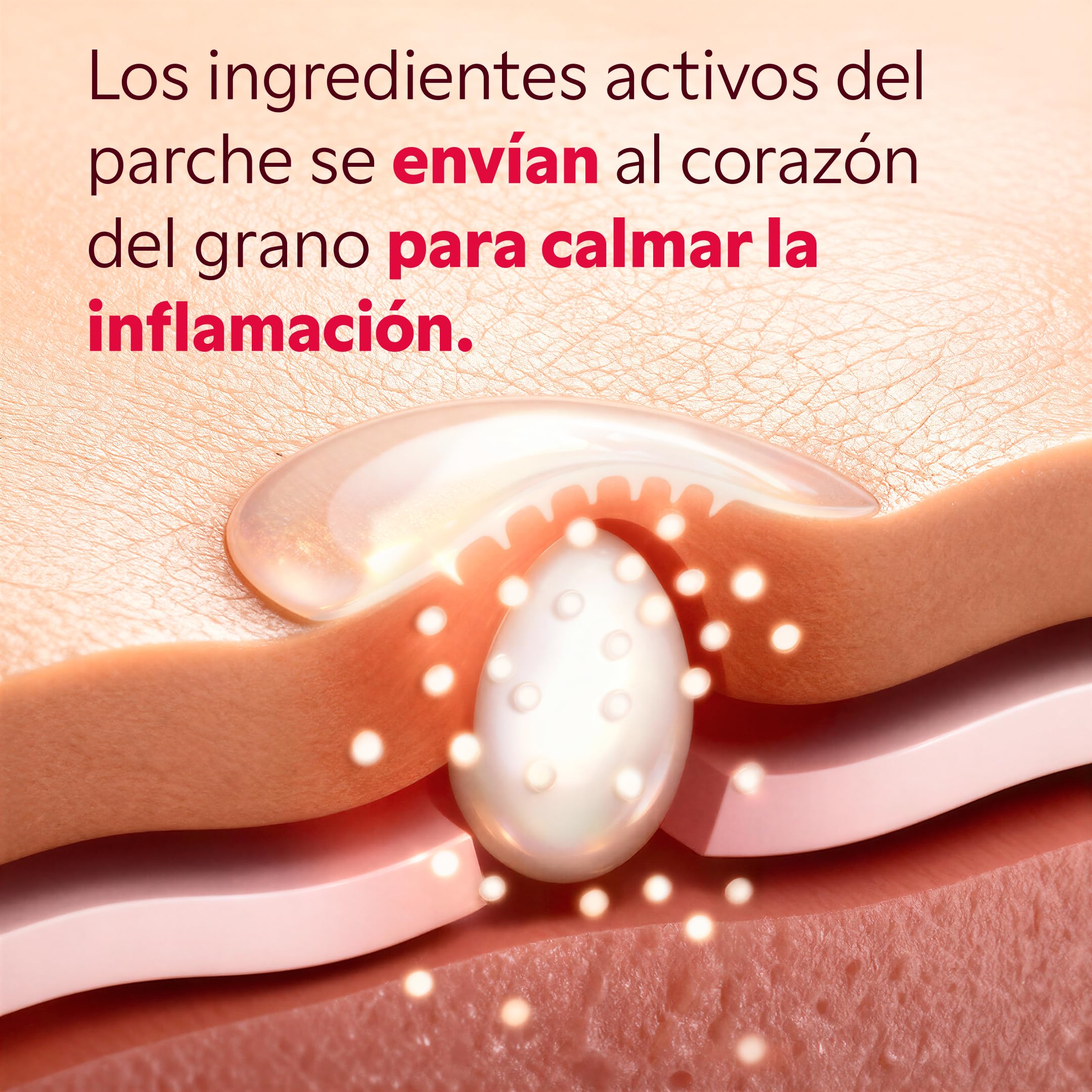 Parche de botón My SOS Beauty – Tratamiento dirigido para botones subcutáneos – Ácido Salicílico y aceite de árbol de té – Parche de micropunto – Acción rápida – Pack de 9 parches