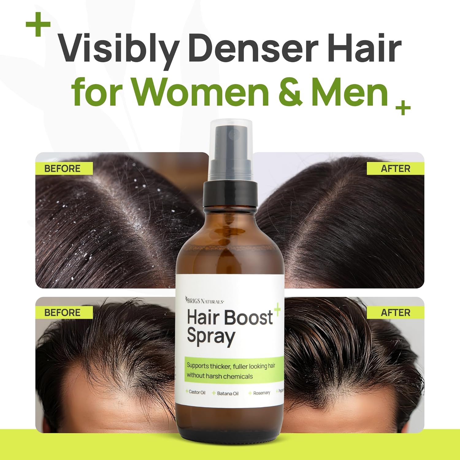 Hair Boost Spray for Thicker Looking Hair and Healthy Scalp - USA Made with Organic Botanicals, Rosemary Water, Peppermint, Biotin, Batana Oil, Caffeine, and Haircare Actives