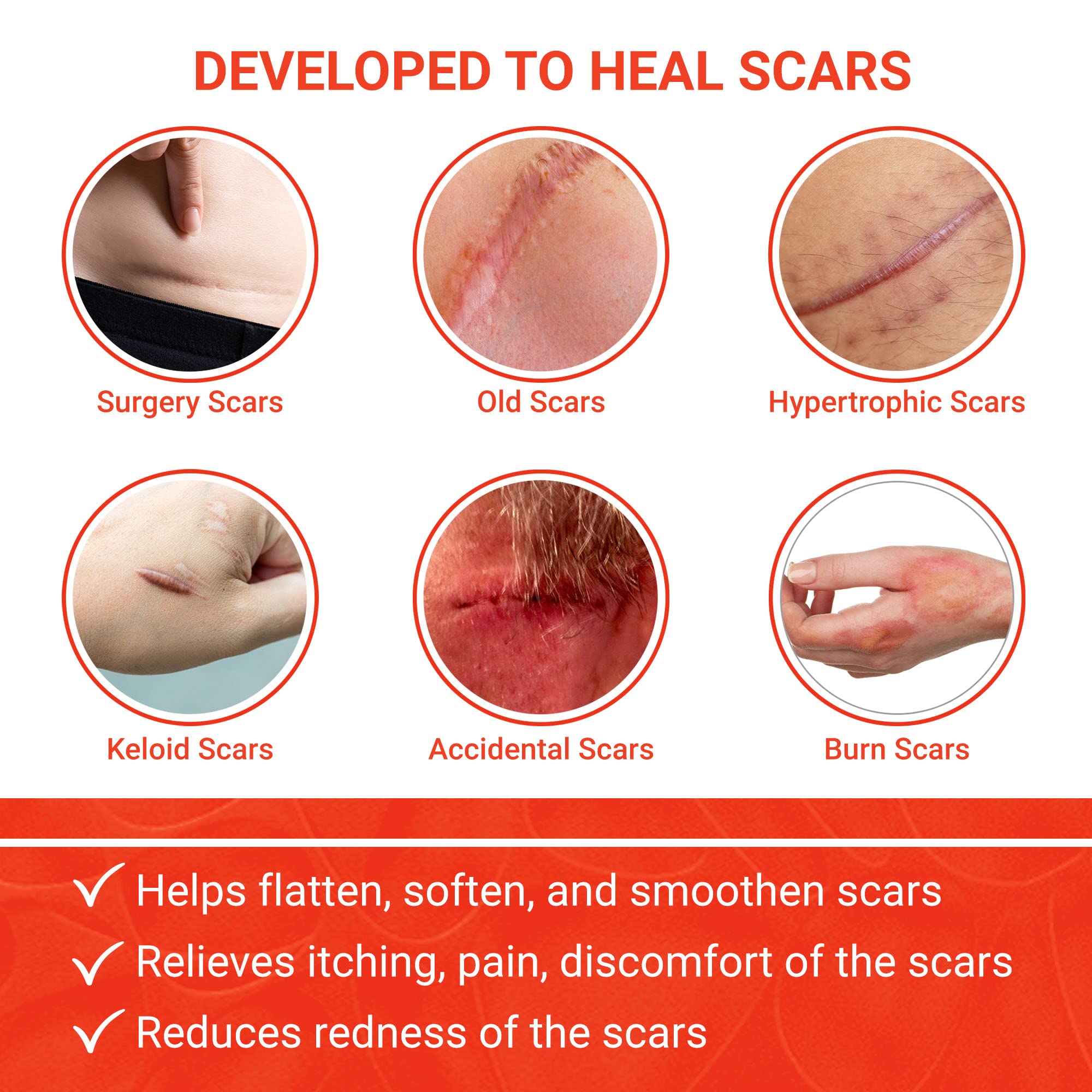 Nourisil MD Silicone Scar Gel with Vitamin E, for Keloid and Surgery