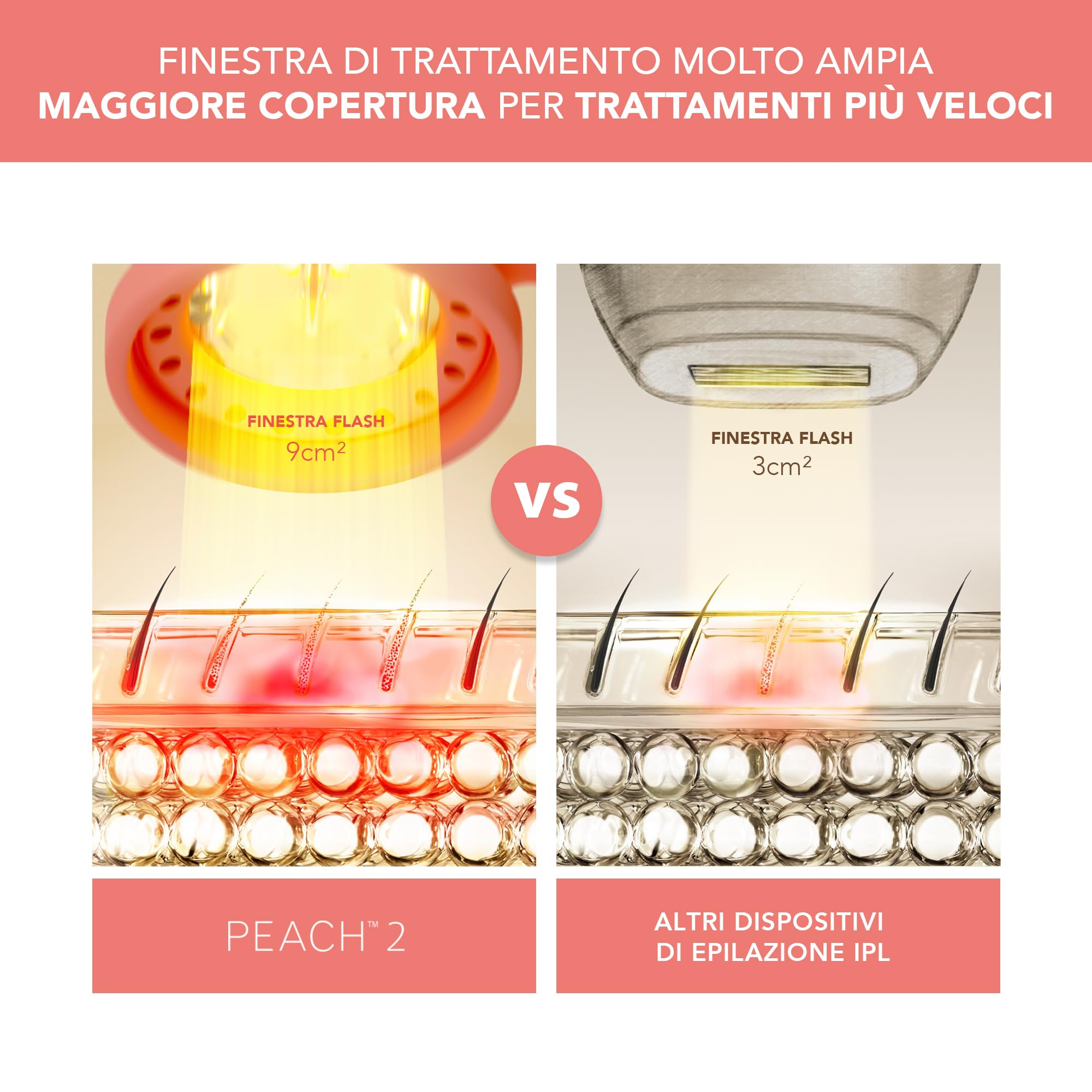FOREO PEACH 2 IPL, Epilatore Luce Pulsata Professionale, Alternativa per Epilatore Laser e Depilazione Laser, Epilazione Permanente Viso e Corpo, 10 min Trattamento, con Cavo | Epilazione IPL E Laser, Viso E Bikini, Raffreddamento Cutaneo, Peli Incarniti,