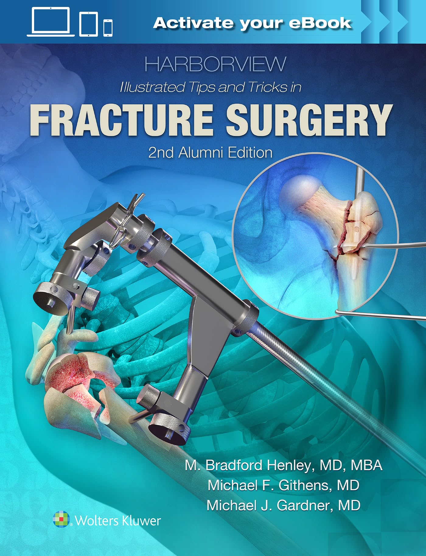Harborview Illustrated Tips and Tricks in Fracture Surgery: Alumni Edition