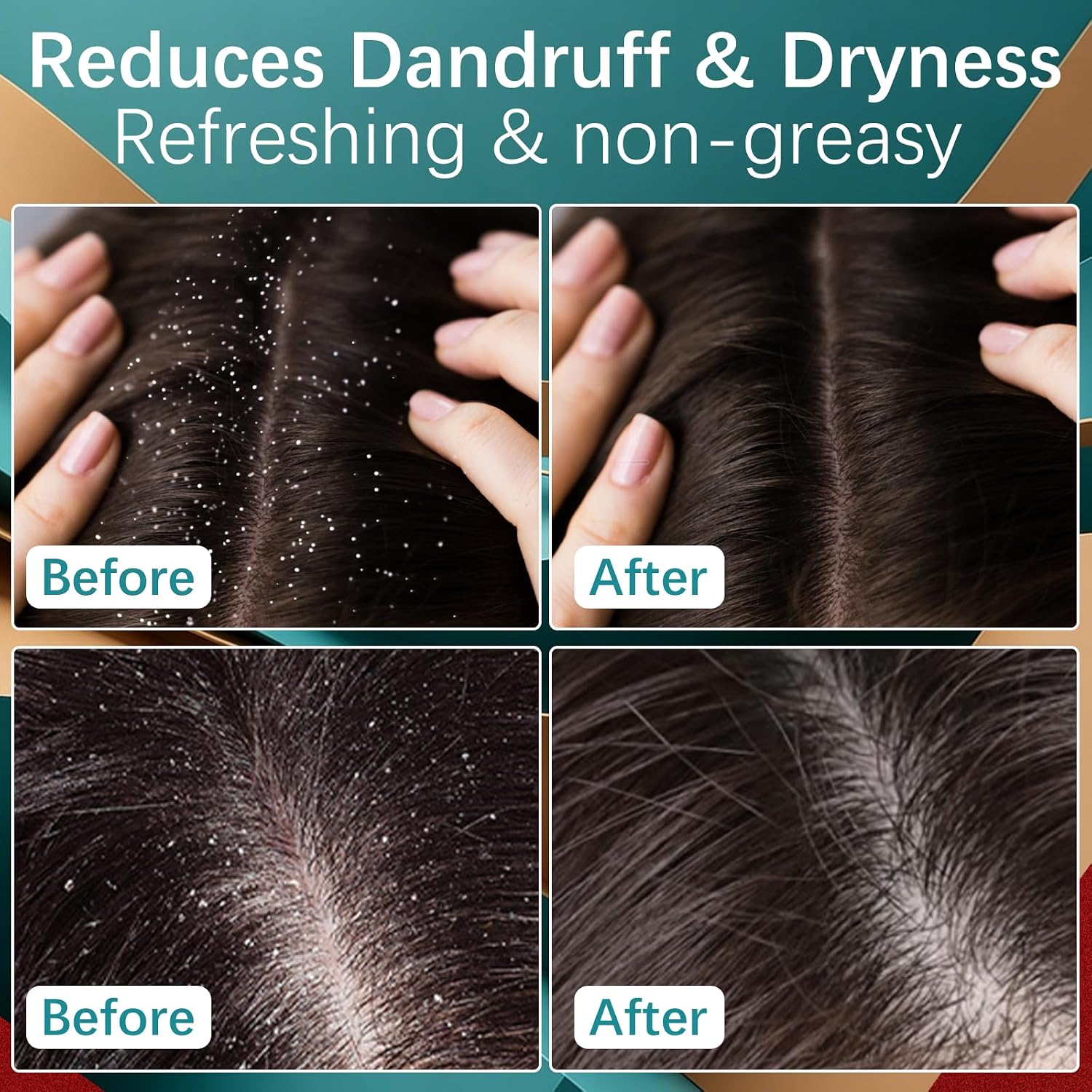 5% Minoxidil Hair Growth Scalp Massage Cream, Professional Hair Care Minoxidil, Anti Hair Loss Treatment with Rosemary Biotin for Men & Women, Fast Regrowth & Strengthens Hair Roots