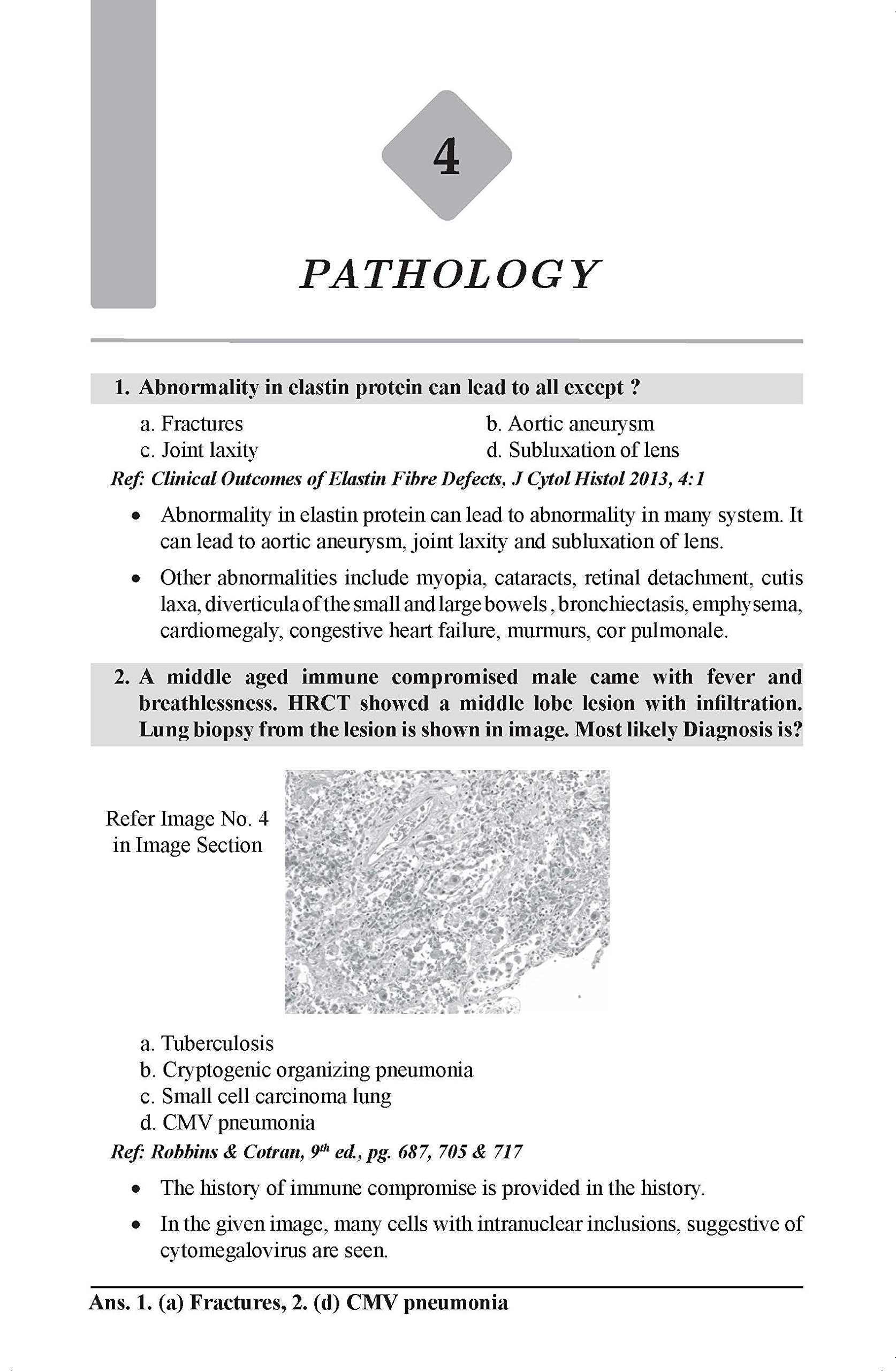 AIIMS PGMEE May 2018 3