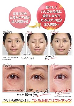 口元 たるみ 引き締め ほうれい線 リストアップ機器 幹細胞 美容液 /オマケ有 楽天市場】美顔器 SALOX 目元 リフトアップ ems ほうれい線