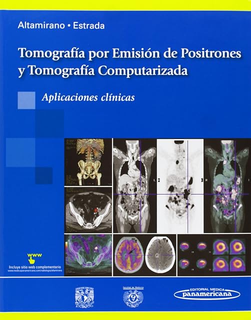 Portada de Tomografía por Emisión de Positrones y Tomografía Computarizada