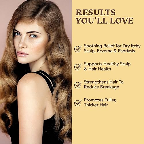 Miniatura 2 de Juego de champú y acondicionador para eccema y psoriasis para hombres y mujeres (paquete de 2) - Aloe Vera y miel de manuka para picazón suave,