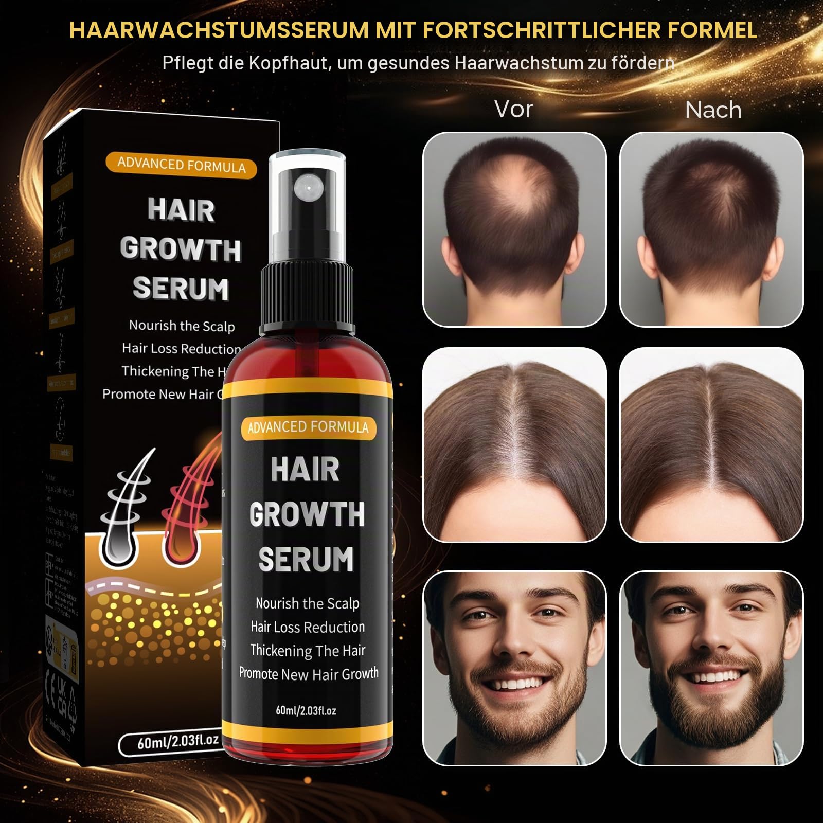 Haarwachstumsserum Spray für Männer/Frauen,haarwachstum beschleunigen,Verhindert Haarausfall,Mit Biotin und Rosmarin für Haarwachstumsöl, haaröl wachstum,bart wachstum,Sanft,Trocken,60ml(3er Pack)