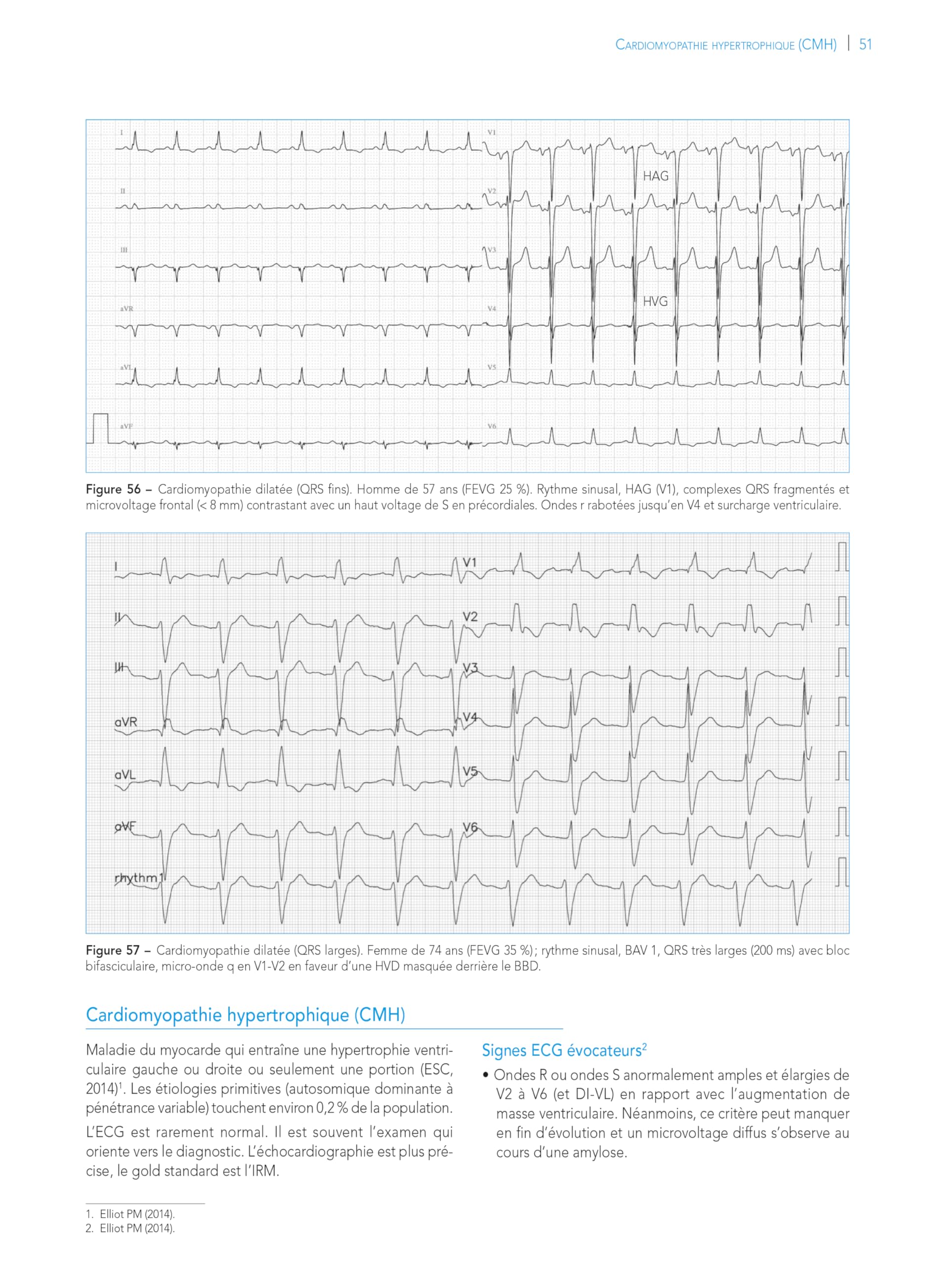 L'ECG de A à Z, 2e éd.