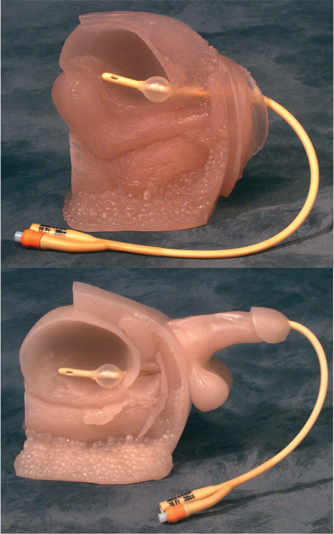 Catheter Model Set (2)