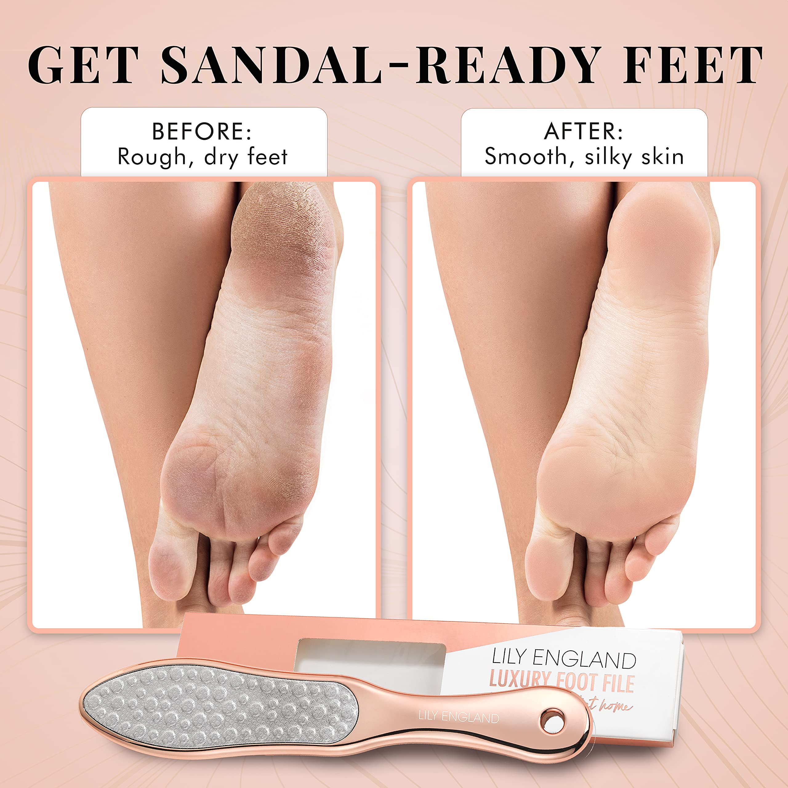Lily England - Lima de pies para eliminar piel dura, 2 en 1 profesional y removedor de piel seca para pies, herramienta de pedicura de acero inoxidable de Lily England, oro rosa
