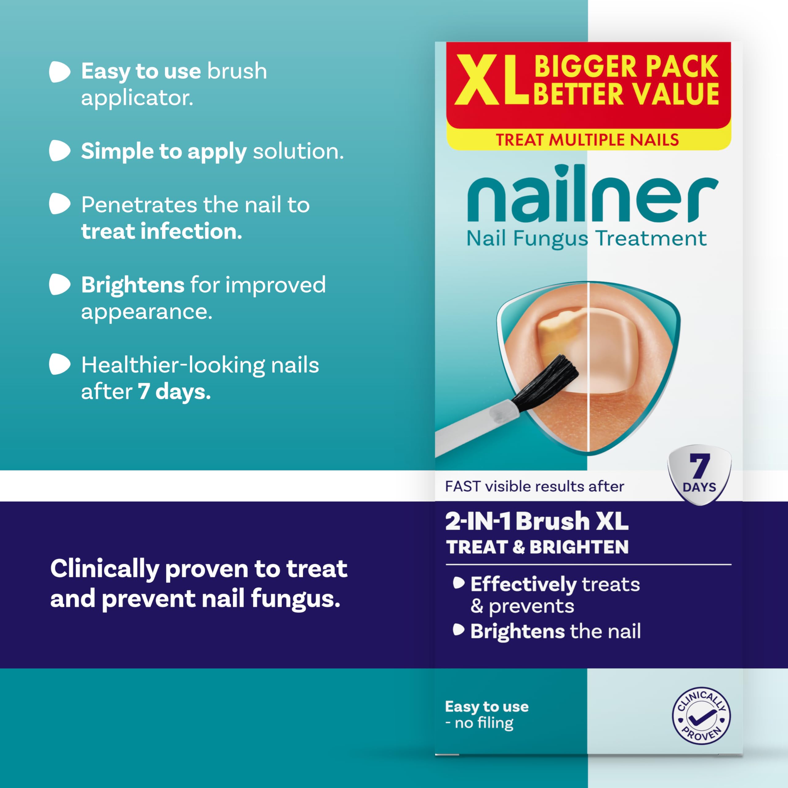 Nailner 2-in-1 Fungal Nail Treatment Brush 14 ml, Treat - Image 2