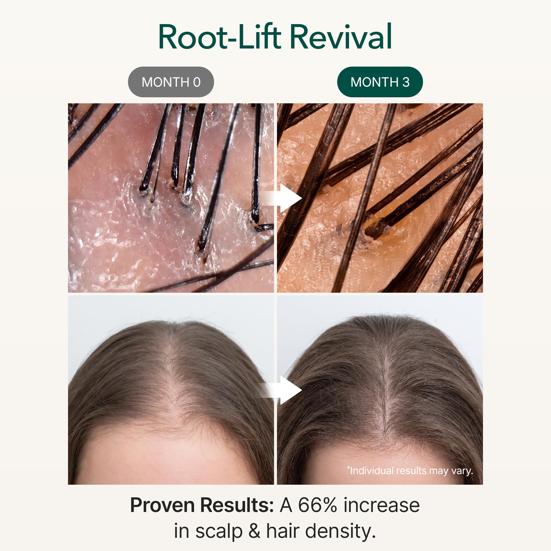 ViveLab Micro Foam Scalp Treatment with Biotin, Rosemary Oil & Caffeine