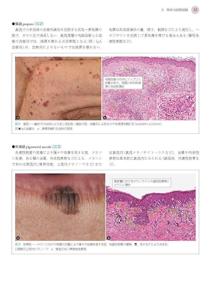 1冊でわかる皮膚病理 1冊でわかる皮膚病理 | 株式会社文光堂