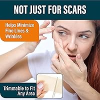 Vista 2 de NUVADERMIS Hojas de silicona para cicatrices – Hojas de cicatrices extra largas para cesáreas, abdominoplastia, queloides y cicatrices quirúrgicas