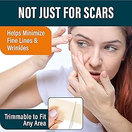 NUVADERMIS Silicone Scar Sheets - Extra Long Medical-Grade Scar Sheets for C-Section, Tummy Tuck, Keloid, and Surgical Scars - Reusable and Effective - Pack of 4 - Medium Tone