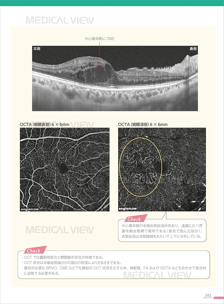OCT読影トレーニング メジカルビュー社｜眼科｜新OCT・OCTA読影トレーニング