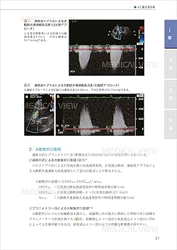SHDインターベンション治療のための心エコー図マニュアル | 吉田
