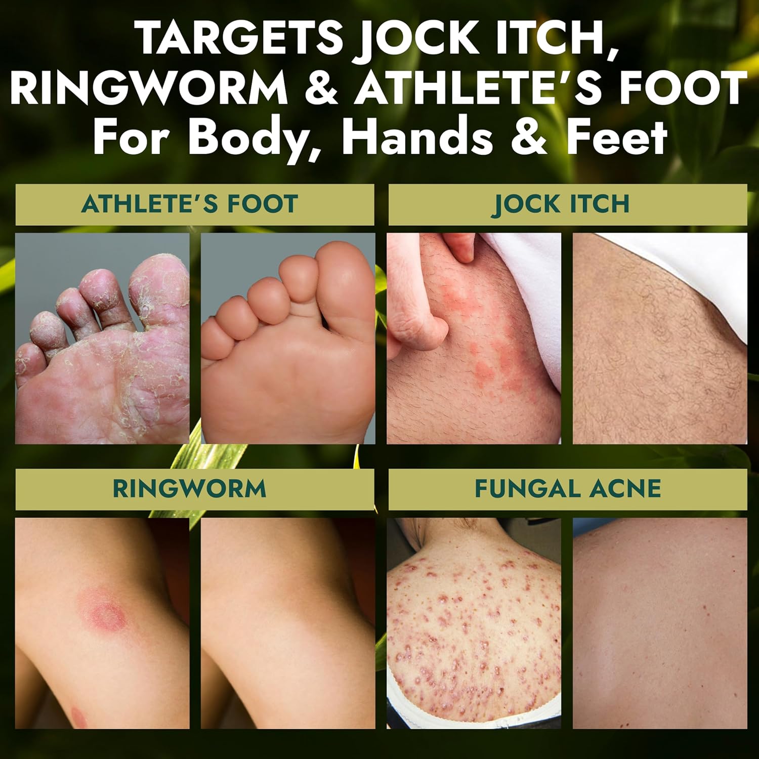 Antifungal Soap Pack of 2 | Medicated Jock Itch Treatment, Fights Ringworm & Athlete's Foot | Antifungal Soap Includes Scrubber for Deeper Cleansing & Exfoliation | Tea Tree Oil 1% Tolnaftate