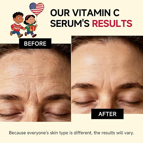 Miniatura 4 de Vitamina C Gloss Serum coreano  Complejo estabilizado con ácido hialurónico y piel facial opaca Centella, tono desigual, líneas finas, poros, piel