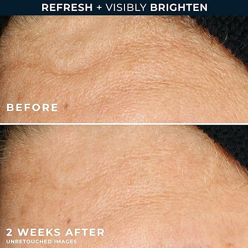 Miniatura 5 de RoC Multi Correxion Revive + Glow - Limpiador facial de gel con vitamina C y ácido glicólico, 177 ml.