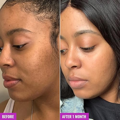 Miniatura 5 de Good Molecules Tónico exfoliante glicólico, tónico diario de ácido hialurónico y glicólico para la cara, exfoliante facial limpiador para un tono de