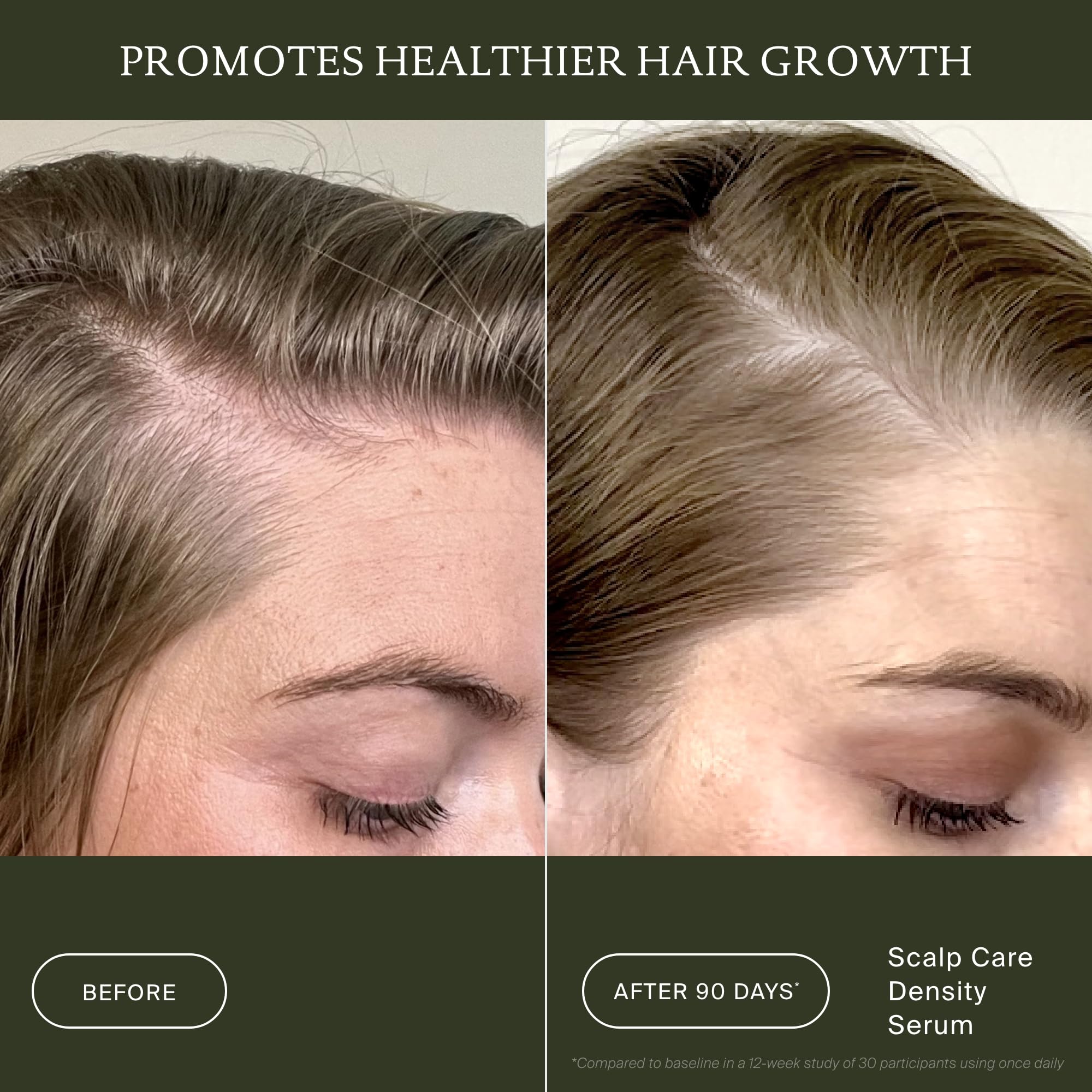 Living Proof Scalp Care Density Serum (50ml) – Serum für gesunde Kopfhaut & Haardichte – Gegen Haarausfall & graues Haar – Schnell einziehend & nicht ausspülbar – Für volleres, kräftigeres Haar