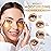 PatchRx Gold Under Eye Patches (144 Patches) for Puffy Eyes and Dark Circles with Pure Collagen, 24K Eye Gel Pad Masks for Reducing Eye Bags, Puffy Dark Circles, Wrinkles, and Fine Lines