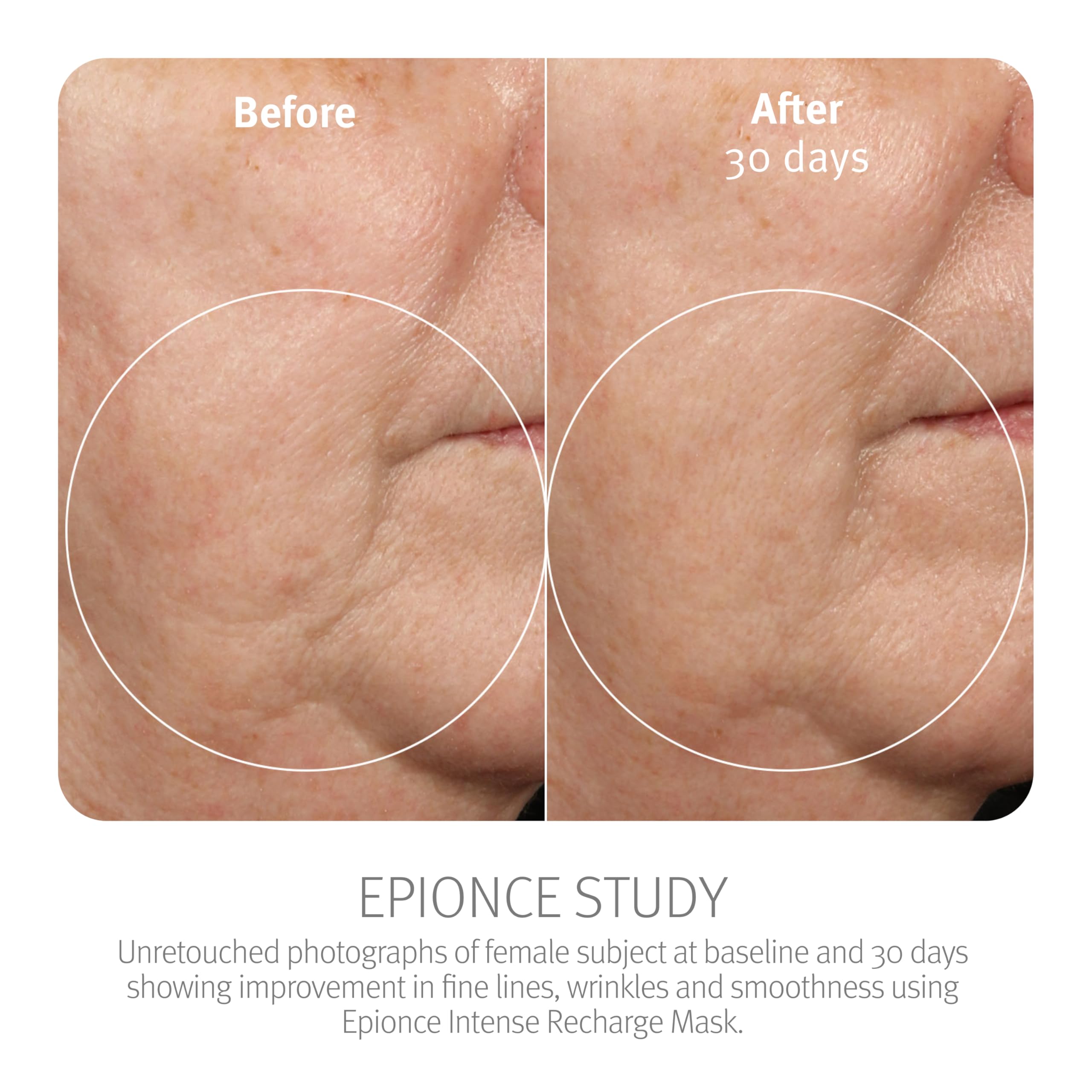 Epionce Intense Recharge Mask - Anti-Aging Clay Face Mask for All Skin Types, Hydrating Mask with Kaolin for the Skin Barrier, Dermatologist Skincare