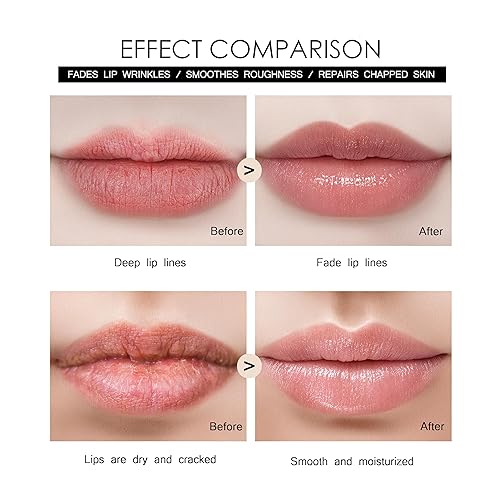 Miniatura 3 de Derma - Rodillo de 0.010 in con depósito de líquido, rodillos faciales para mujeres, rodillos para labios, piel y barba para hombres, 105 agujas de