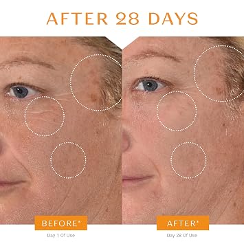 Yon-Ka 20% Vitamin C Serum, Anti-Aging Face Treatment