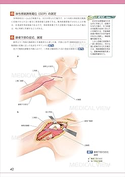 末梢神経障害・損傷の修復と再建術 OS NEXUS 末梢神経障害・損傷の修復と再建術 (OS NEXUS(電子版付き) 17