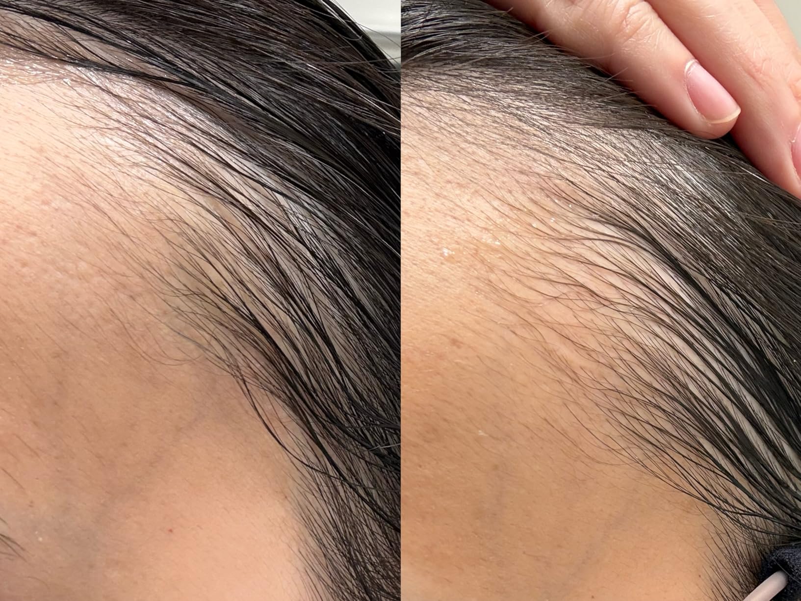 lilyeve GROWTURN Hair Growth Serum with Built-in Brush, Heartleaf-Derived Exosomes to Revitalize & Thickening Hair, Hair Growth Accelerator - Korean Hair Care, 1.01 fl. oz. (Pack of 1)
