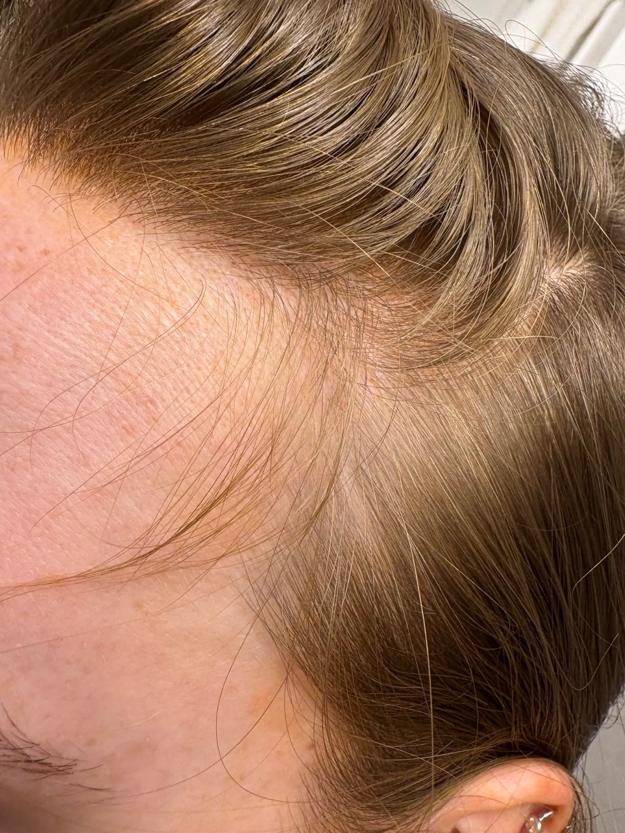 Customer routine photo using Divi Scalp Serum