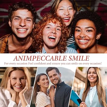 Full Set of Dentures, Clip on Veneers Top and Bottom with 50g Tube, False Teeth Veneers for Men and Women