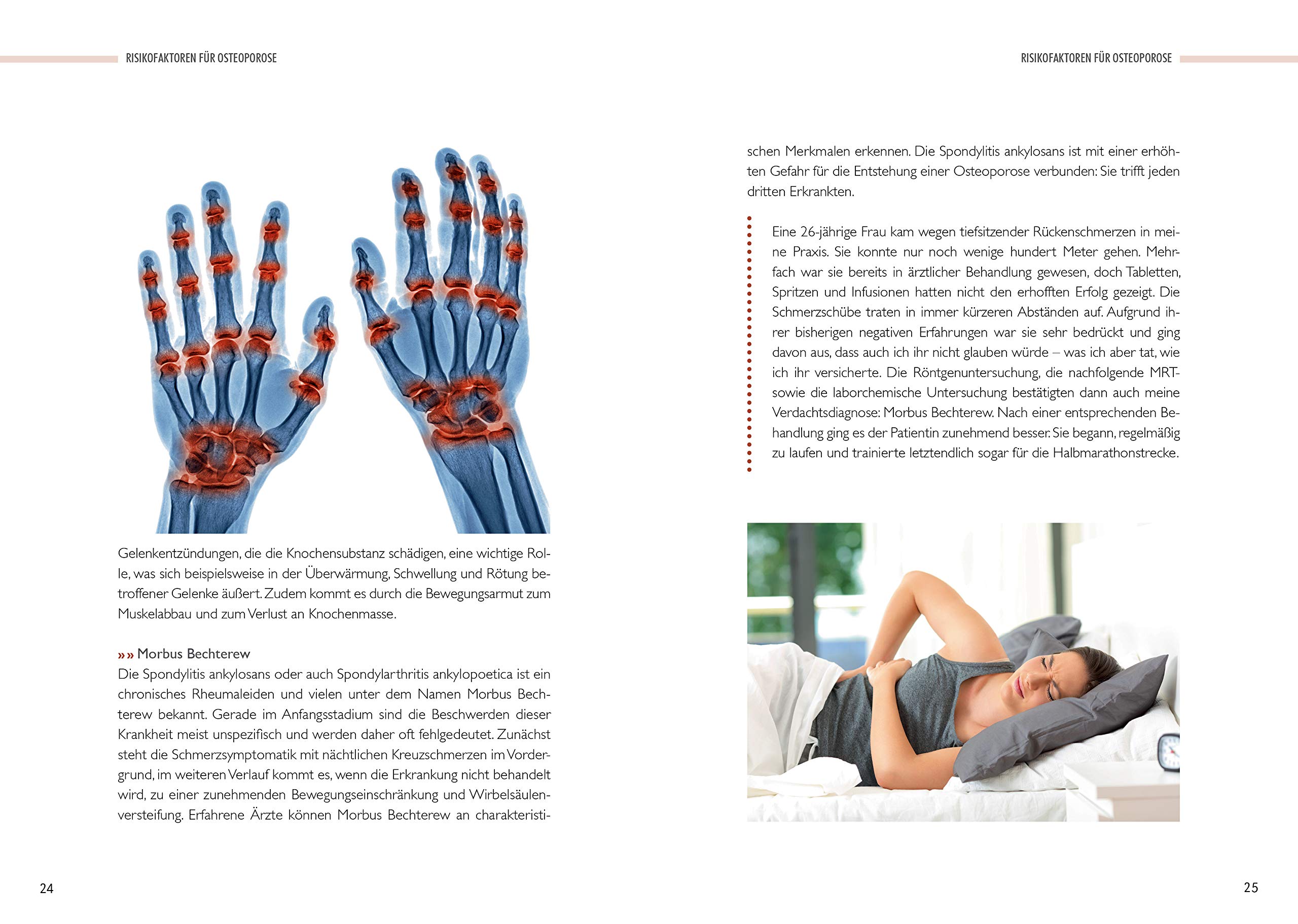 Starke Knochen: Osteoporose richtig behandeln - Diagnose, Therapie und Vorsorge