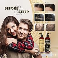 Vista 7 de DHT Pro Shampoo Fórmula avanzada con Procapil y Capixyl, bloqueadores de DHT y extractos naturales, champú antiadelgazamiento para hombres