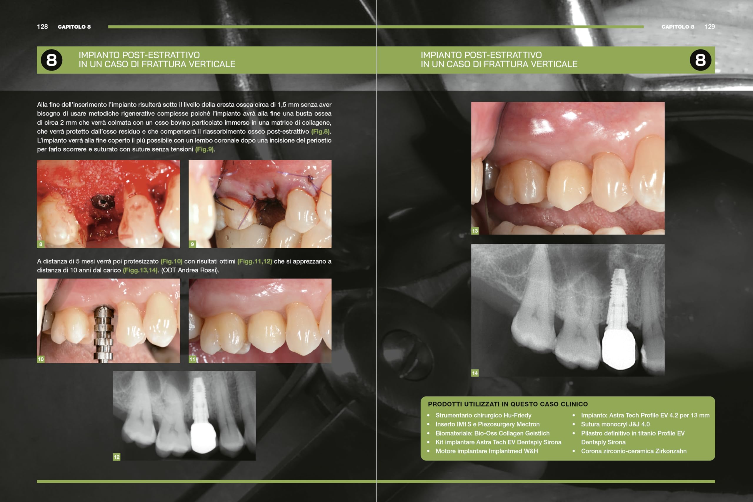 Impianti immediati. Manuale clinico operativo con procedure step by step