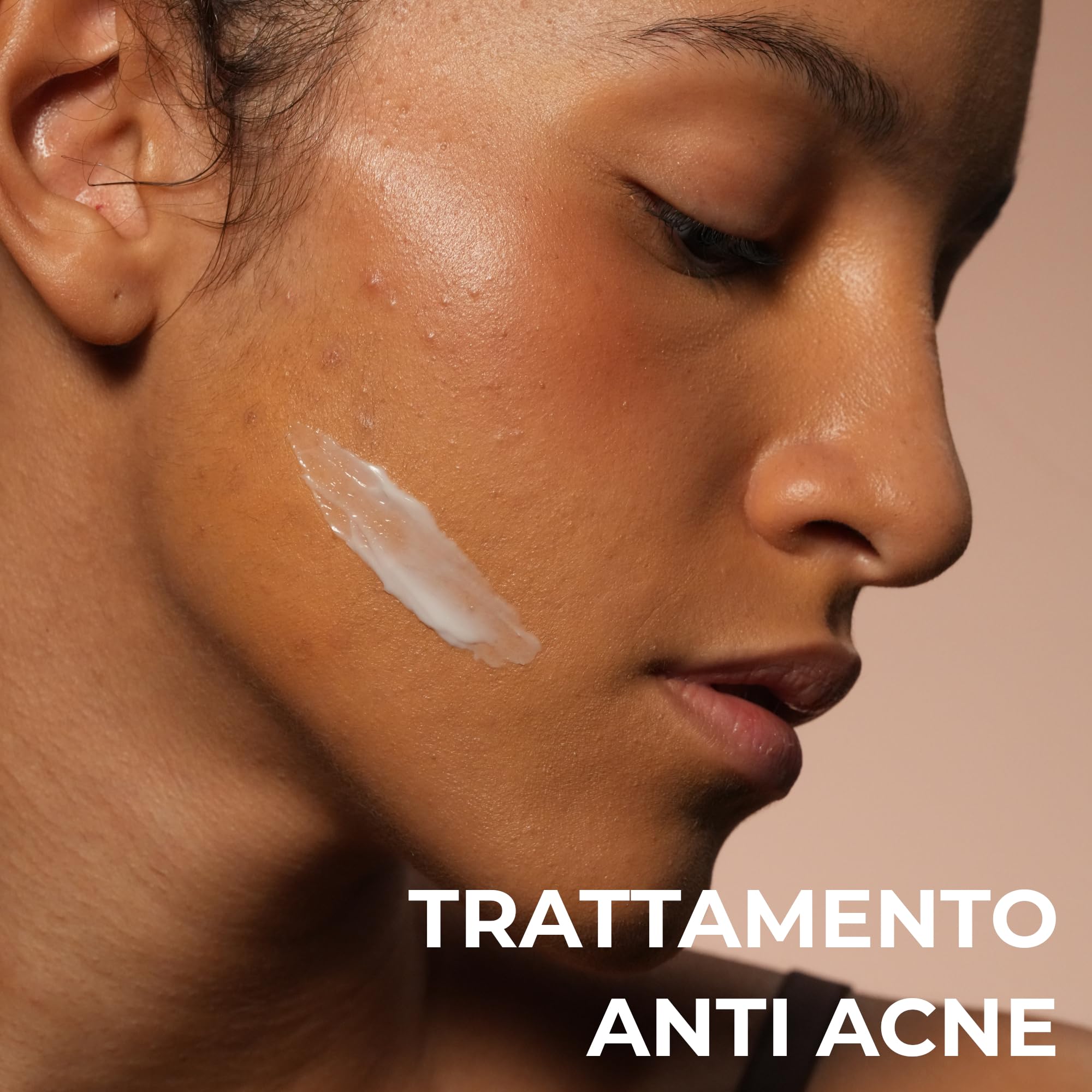 ALKEMY Crema Brufoli Viso, Trattamento anti Acne Dermatologicamente Testato, Riduce Brufoli, Imperfezioni, Rossori, Azione Purificante e Lenitiva per pelle a tendenza acneica, Cosmetica Naturale, 50ml