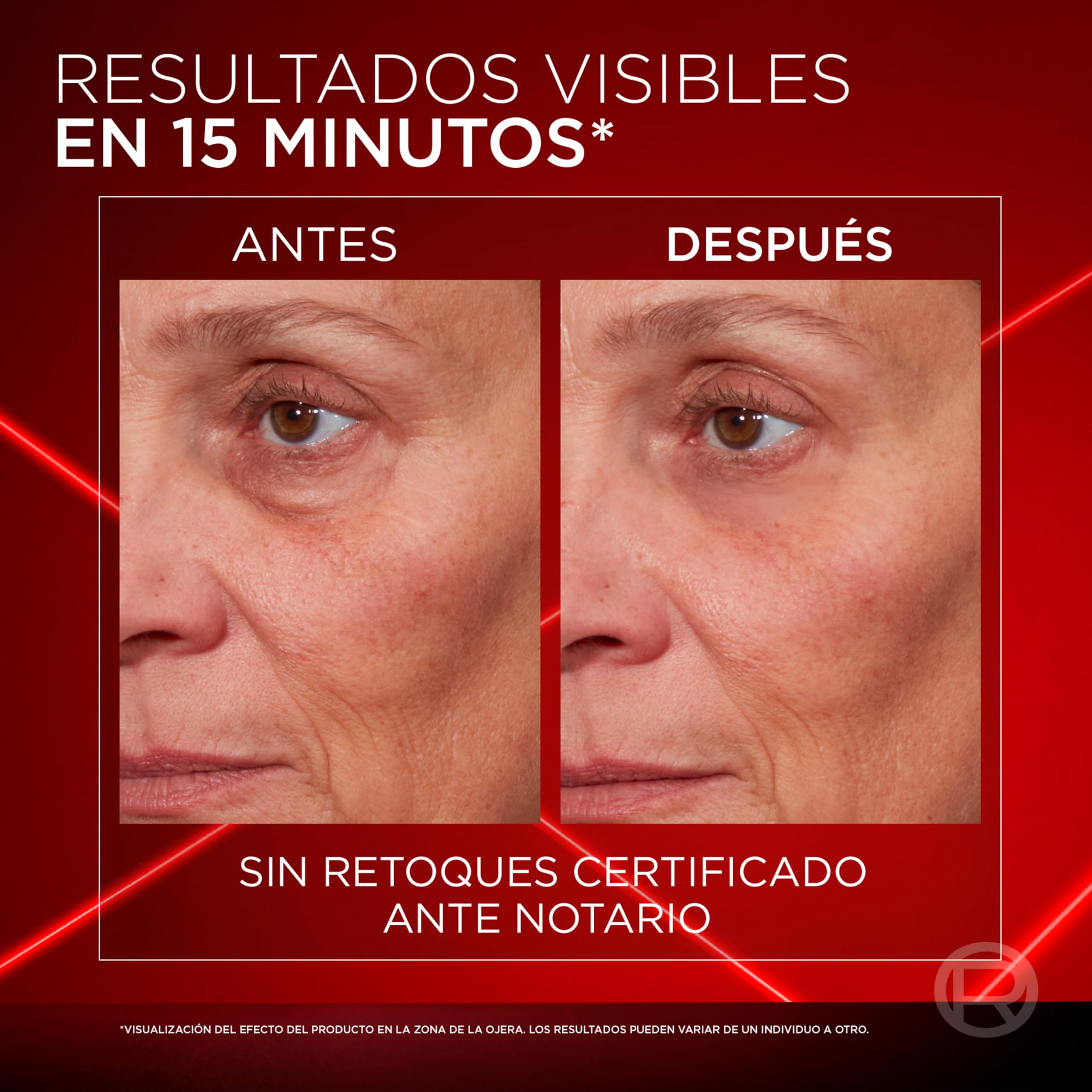 L'Oréal Paris Revitalift Laser Eraser Borse Istantaneo. Sgonfia e Alisa Borsa degli Occhi in 15 minuti*. Correttore degli occhi. Sguardo fermo e ringiovanito. Contorno Occhi Uomo e Donna.15ml