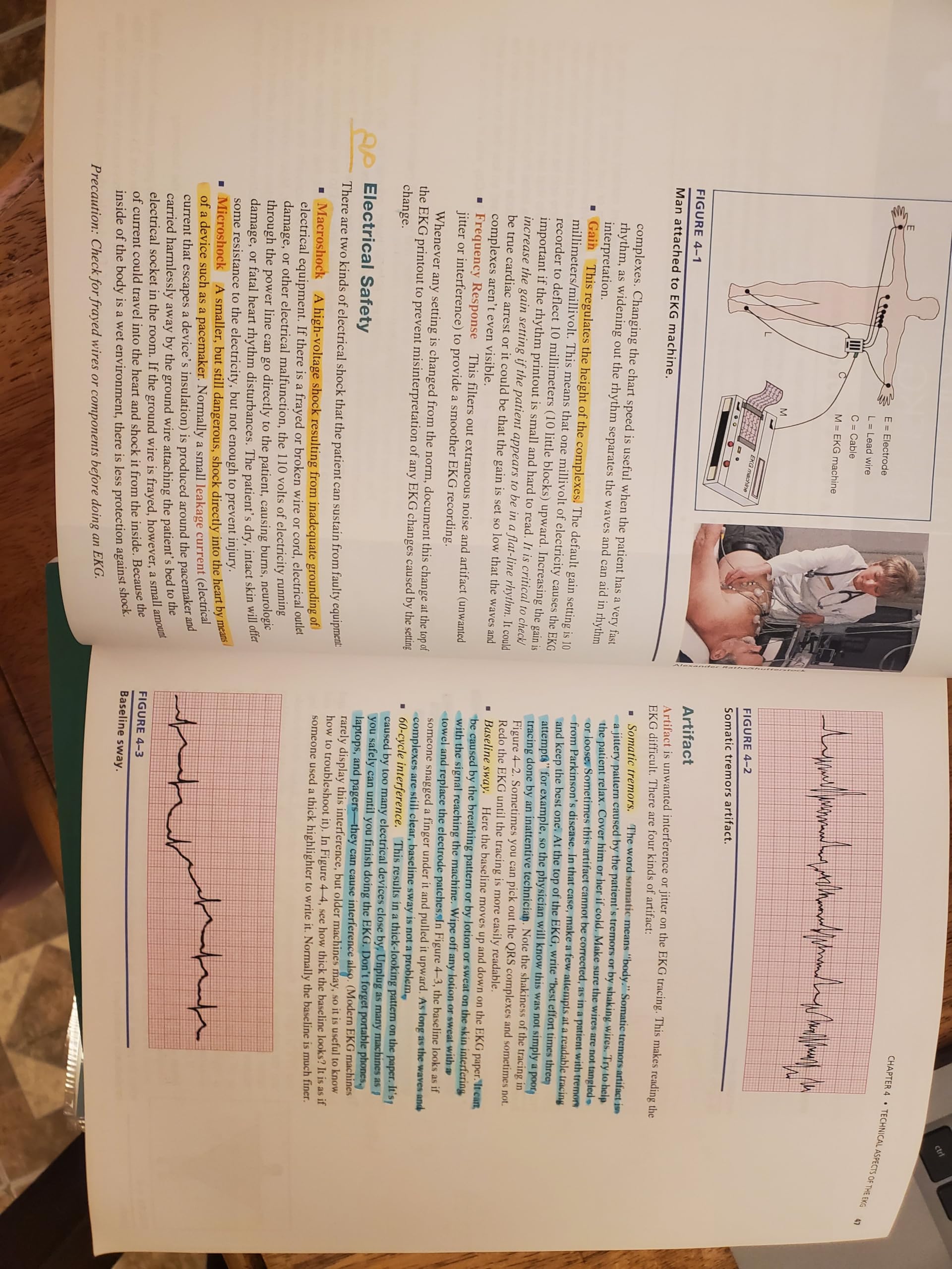 EKG Plain and Simple