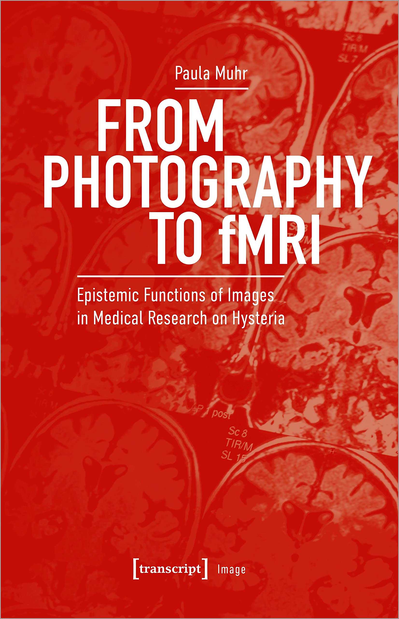 Buy From Photography to Fmri: Epistemic Functions of Images in Medical Research on Hysteria — BookShops.in