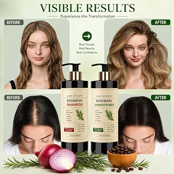 Onion Hydrosol Shampoo for Hair Growth 17.6 fl oz