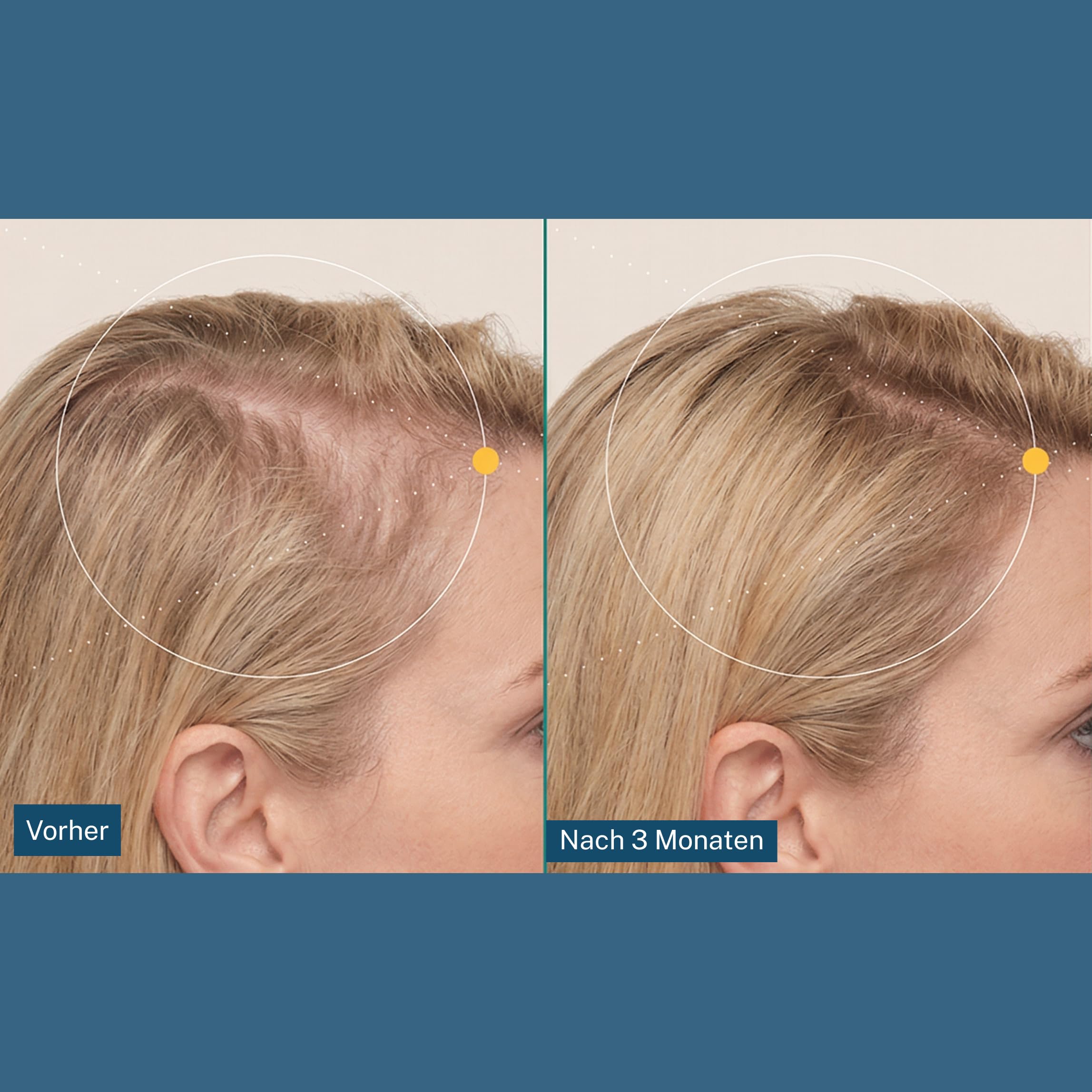 Haarvitamine gegen Haarausfall Frau – Haarwachstum beschleunigen | Wechseljahre Kapseln 30 Stk. - Nahrungsergänzungsmittel mit Amla & Kupfer gegen graue Haare