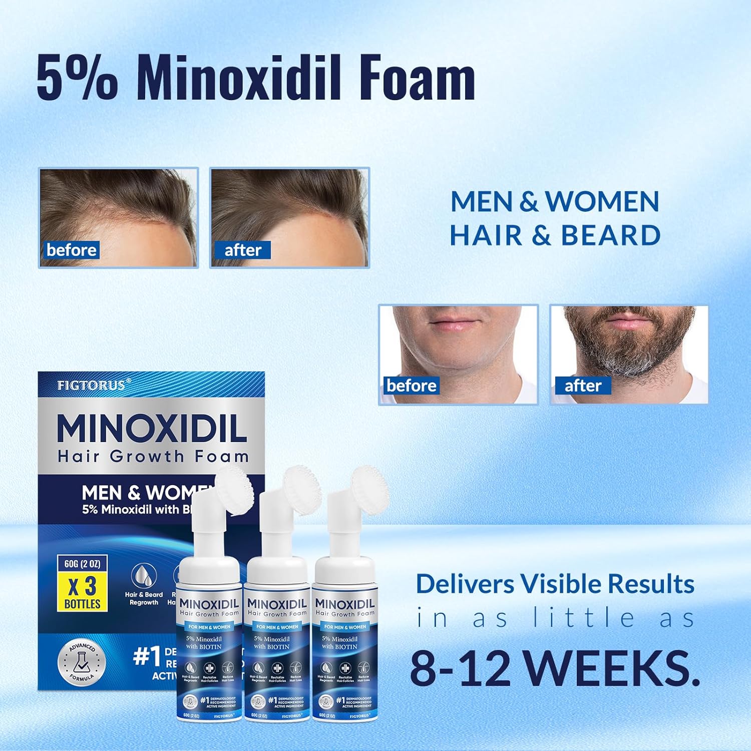 5% Minoxidil Foam, Minoxidil for Men Foam, Minoxidil for Women Hair Growth, Minoxidil for Men and Women. (6 Ounce) - Image 4