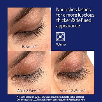 Amazon.com: Obagi Nu-Cil Eyelash Enhancing Serum – Nourishing Lash