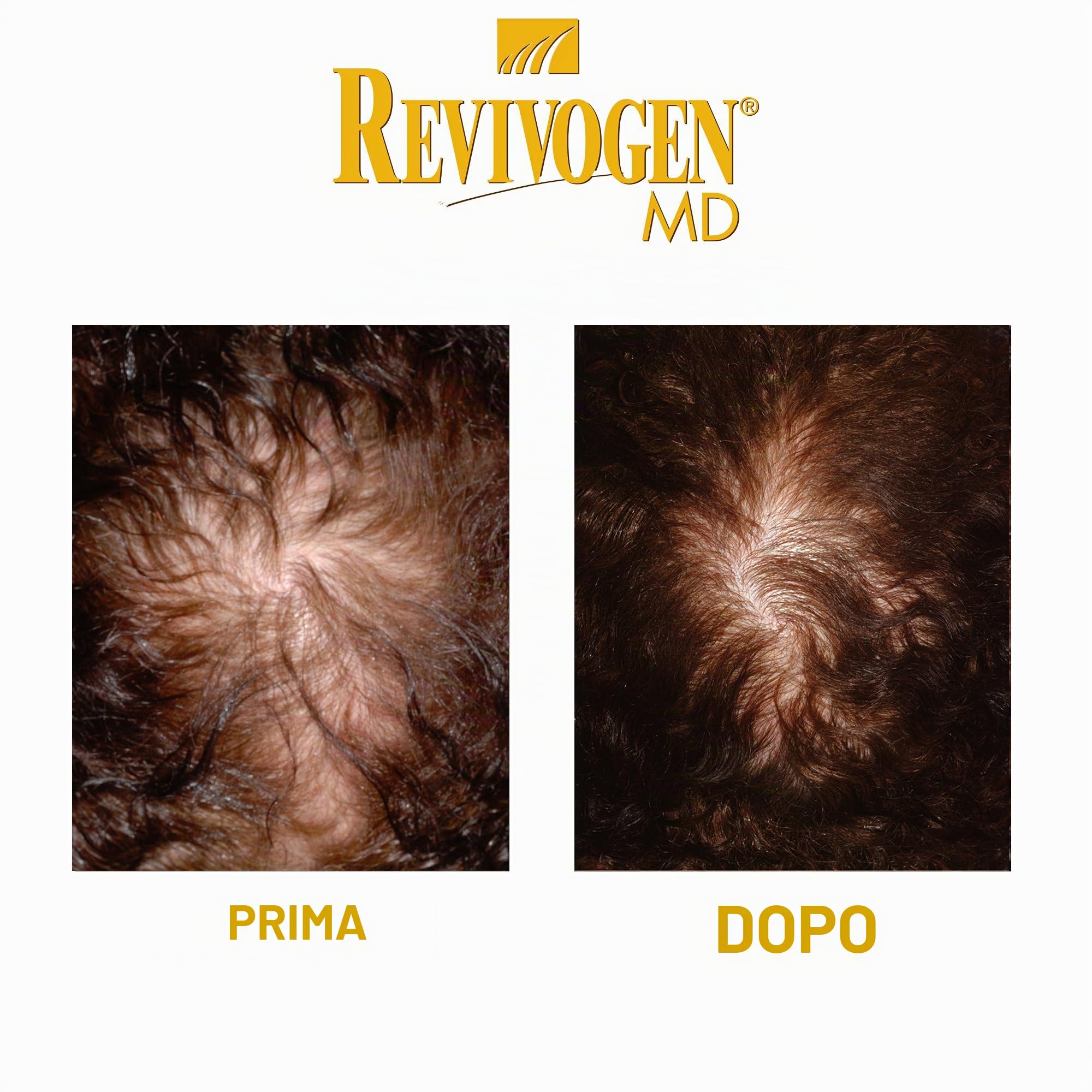 Revivogen MD Shampoo con Scalp Therapy 1 mese