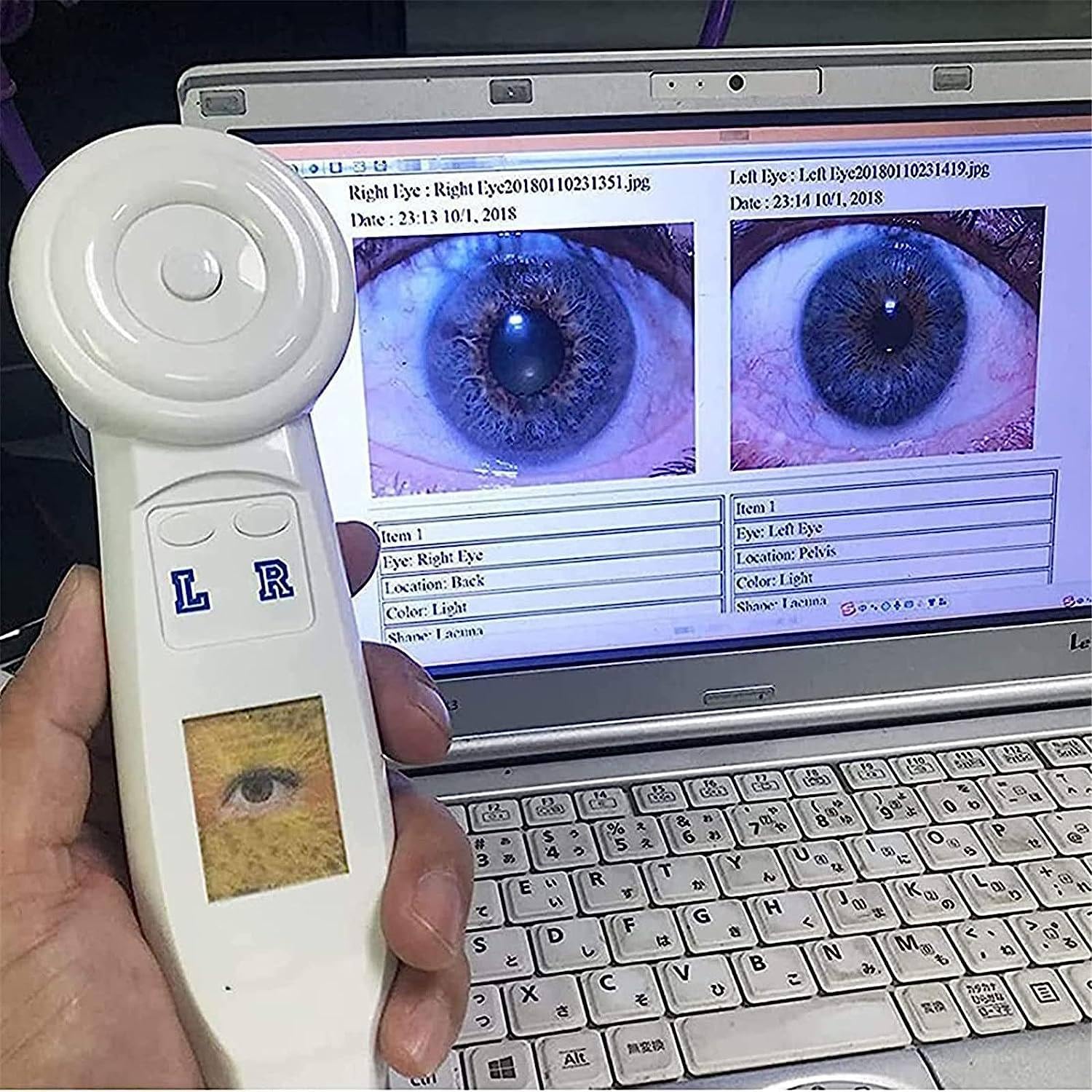 Przenośna kamera irydologiczna 5.0 MP USB HD 2 miliony pikseli Detektor tęczówki Lupa tęczówki Oprogramowanie Iris Analizator komputerowy Irydologia Kamera komputerowa 30X