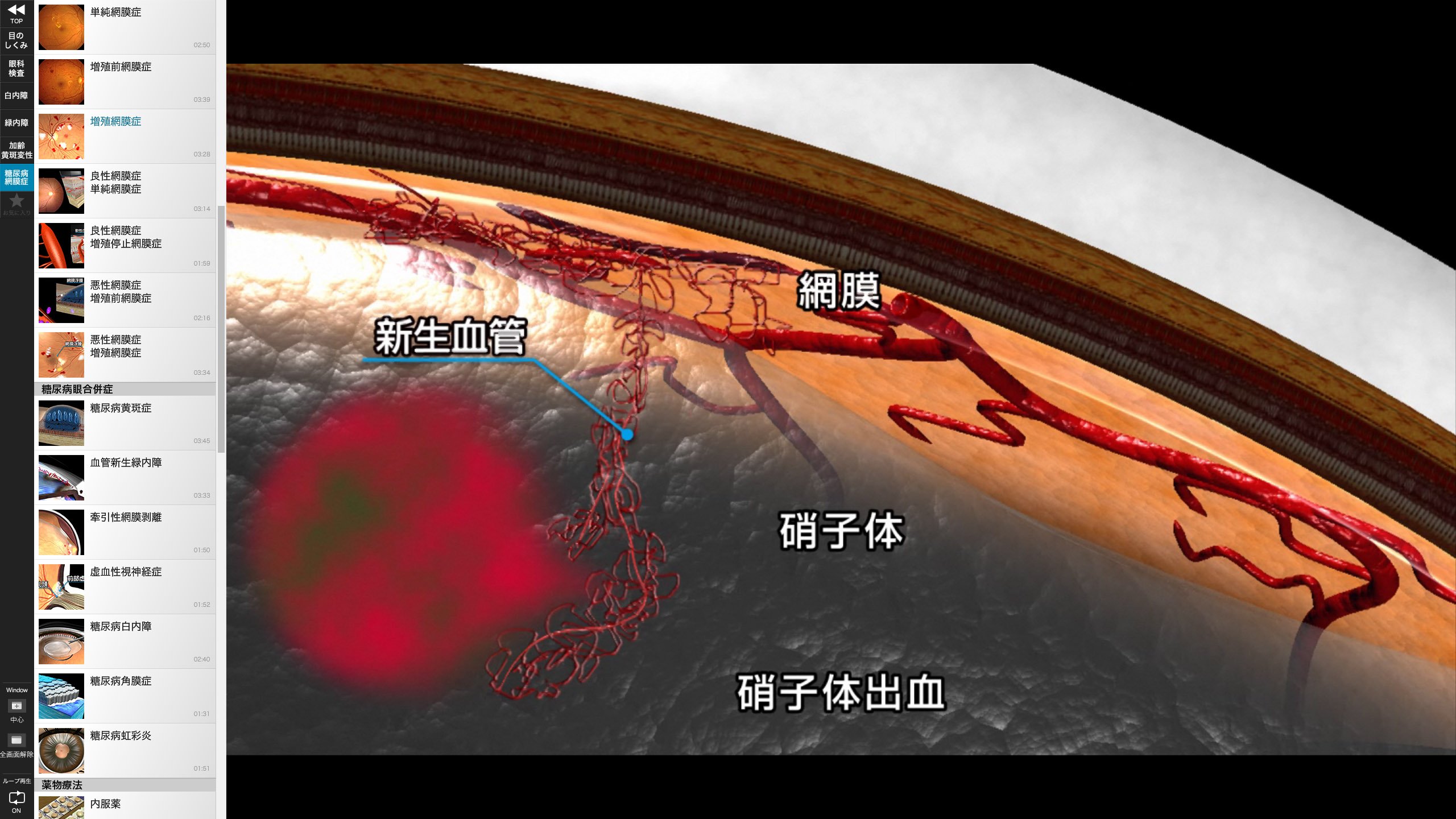 Amazon.co.jp: 眼科 インフォームドコンセント 支援システム iCeye 215