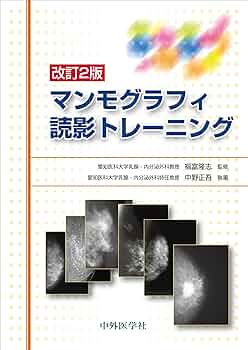 マンモグラフィII 改訂版?読影力をアップさせる厳選62例?【解説強化・症例追加版】 (手にとるようにわかる) マンモグラフィII 改訂版〜読影力をアップさせる厳選62例
